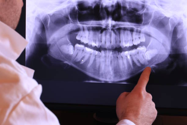 Best Mobile Emergency Dentist in West Sacramento, CA
